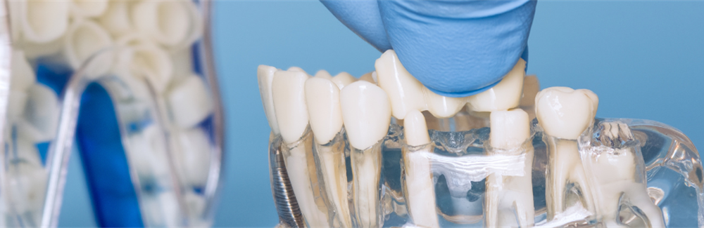 Impact of a Modular Escape Game on Undergraduate and Continuing Dental Education